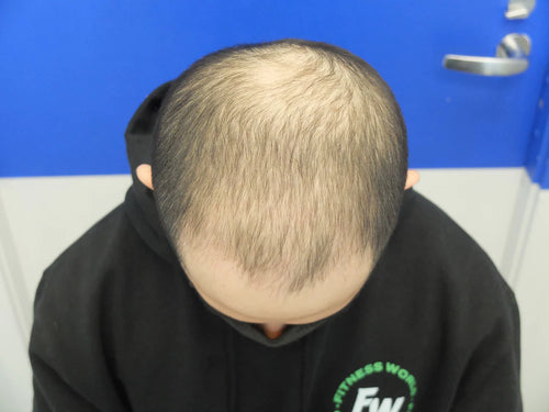 Before