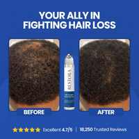 Advanced Hair Growth Roll-on Serum 7
